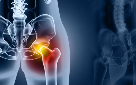 Common Hip Flexor Injuries and Treatments When Walking - The Shoe Box NYC